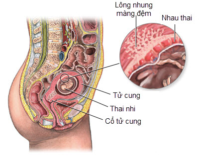 Tụ dịch - Hình ảnh minh họa
